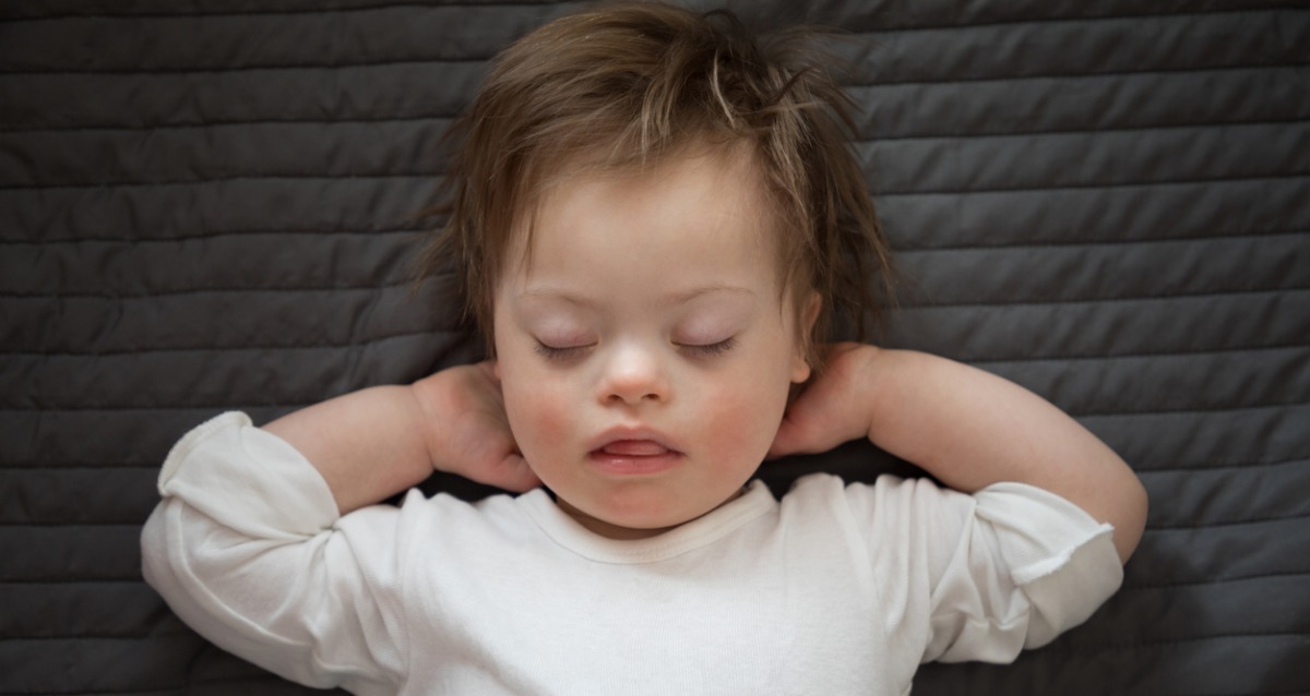 Image of a child with disability, who is sleeping.