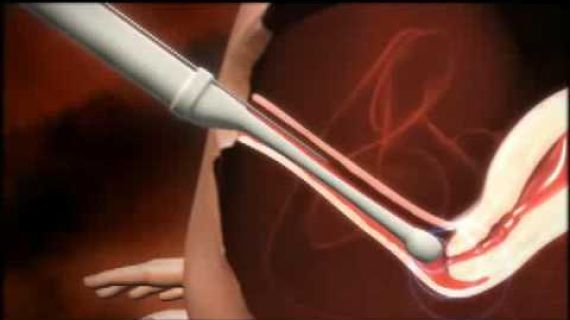 Animated image of body