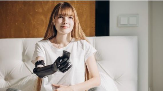 A young woman with long hair, a smile and a prosthetic arm is holding a TV remote and pointing it.